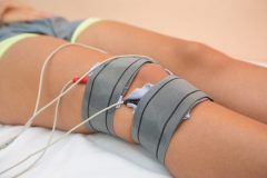 knie-elektro